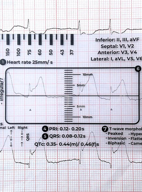 ECG 7-step rule for ECG/EKG interpretation ECG 7-step analy