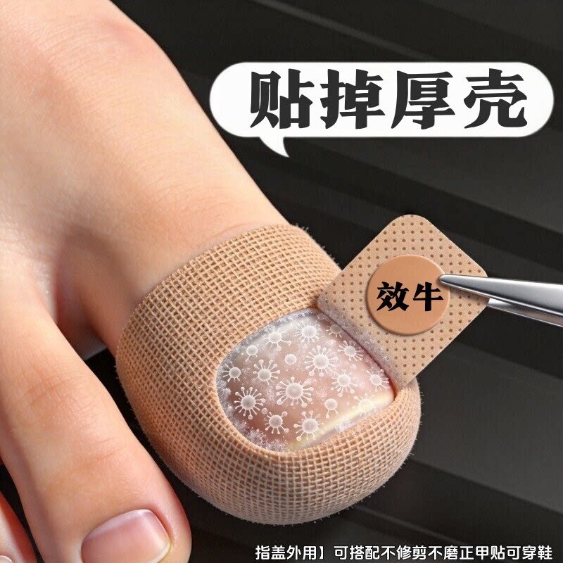 【国药热销】复购率%99 净甲贴正品专用贴植物萃取脚趾手指甲专用