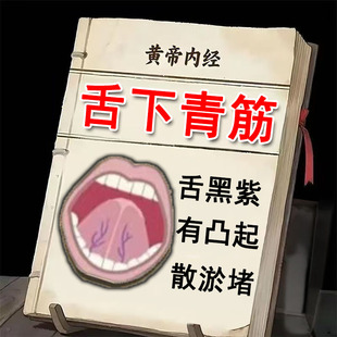 舌下青筋舌底血管怒张青筋凸起又黑又粗淤血疏通专用草本喷剂