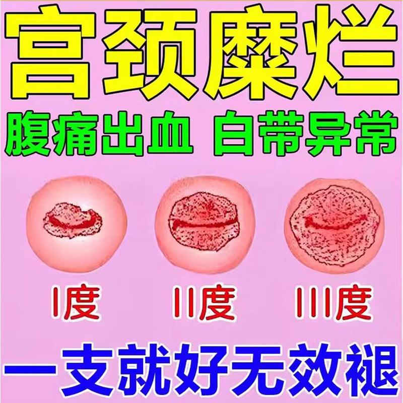 奥硝唑阴道泡腾片圣诺康片
