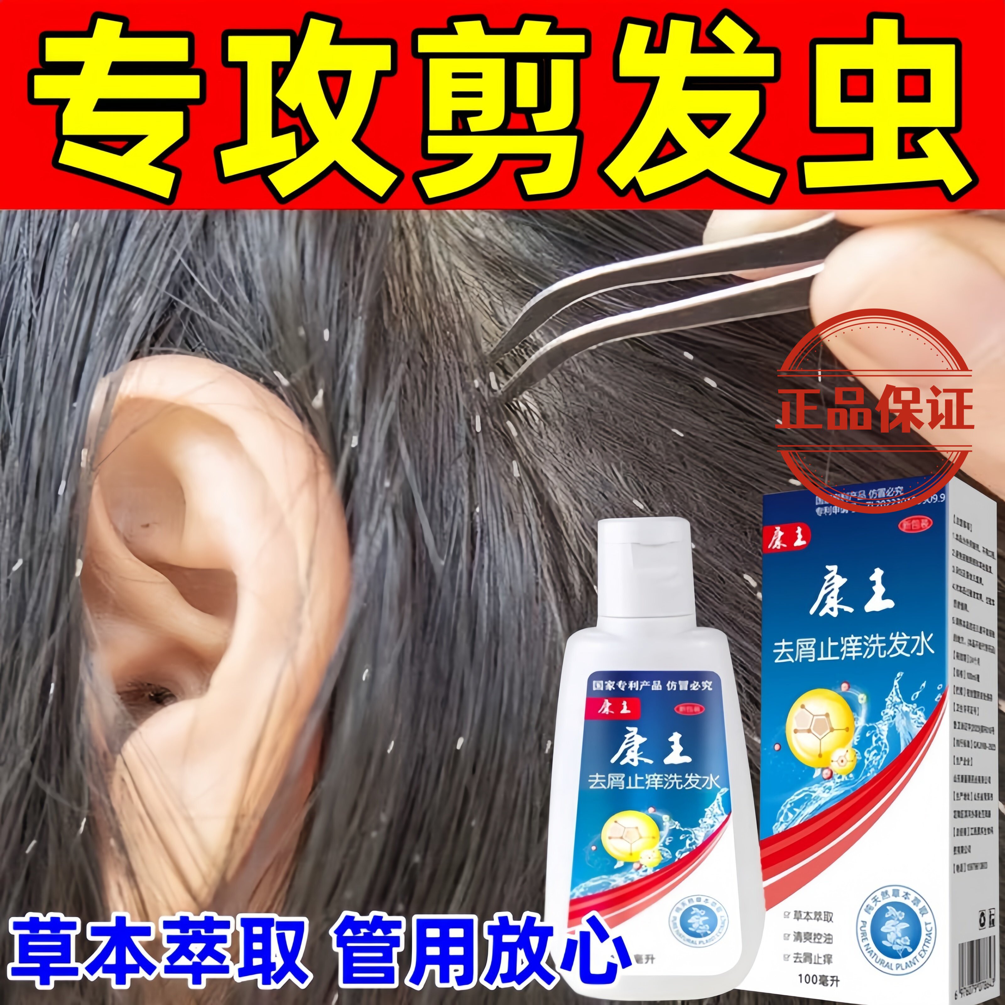 去剪发虫洗发水儿童成人祛屑止痒头发有白点卷发虫除头螨药洗发露