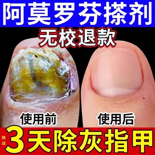 香港大药房官方正品盐酸阿莫洛芬罗芬搽剂灰指甲净亮甲乳膏旗舰店