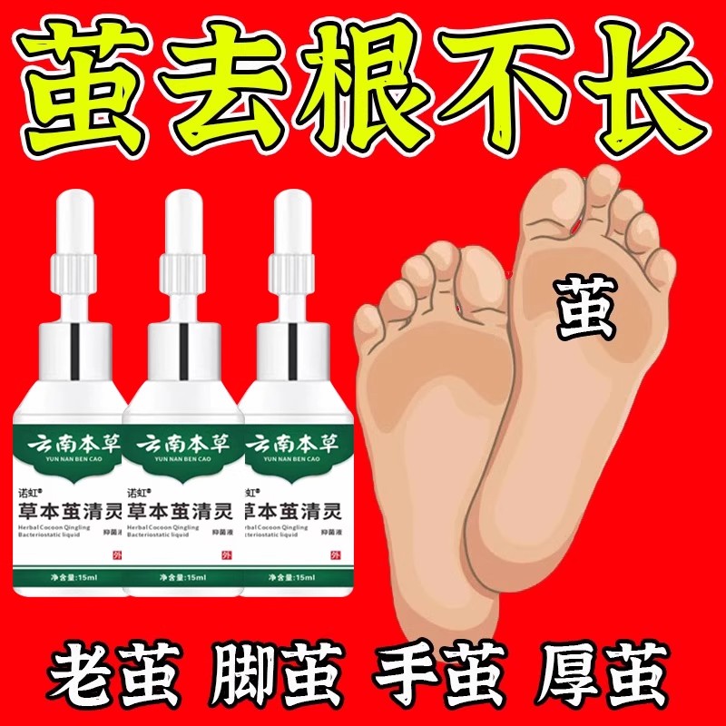 云南本草鸡眼药膏贴老茧官方正品