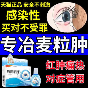 麦粒肿眼贴针眼睛发痒眼药水消炎杀菌滴眼液麦粒肿药膏儿童红眼病