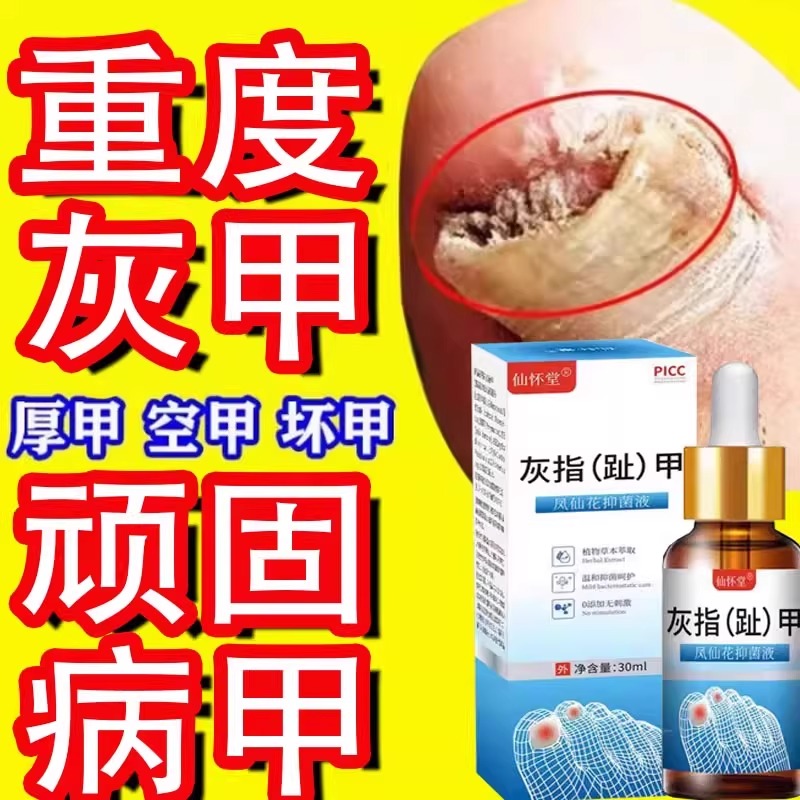 灰指甲亮甲脱甲膏抑菌正品