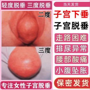 葵花子宫下垂提升中药贴子宫托脱垂膨出中老年人医用修恢复训练器