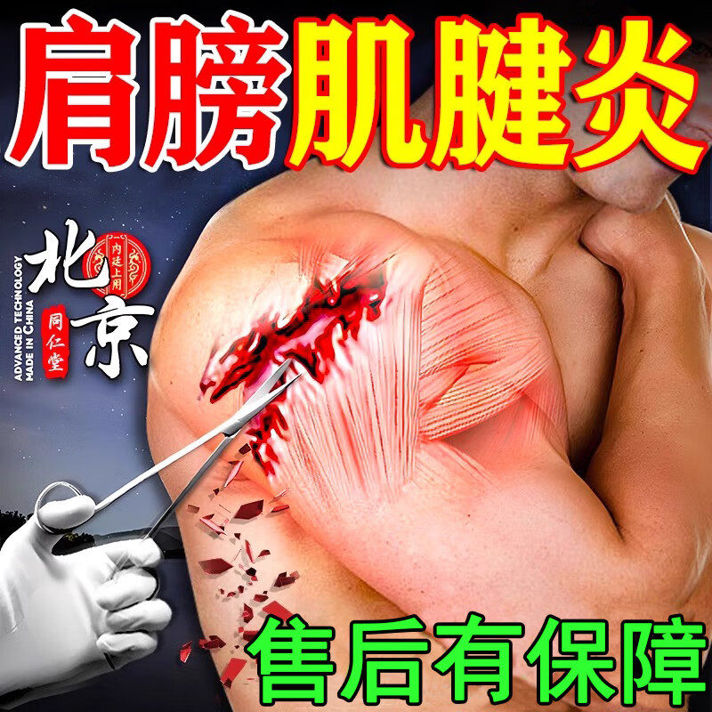 北京同仁堂肌腱炎专用膏药贴治疗的鹅足冈上肌肌腱损伤粘连痛关节