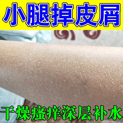 腿痒小腿皮肤干燥起皮秋冬天腿部鱼鳞掉皮屑腿上起干皮去鱼鳞滋润