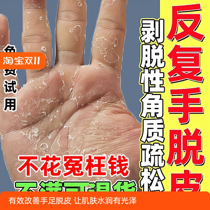 手足脱皮严重脱皮专用真菌蜕皮手指手掌干燥起皮掉皮脚底开裂膏