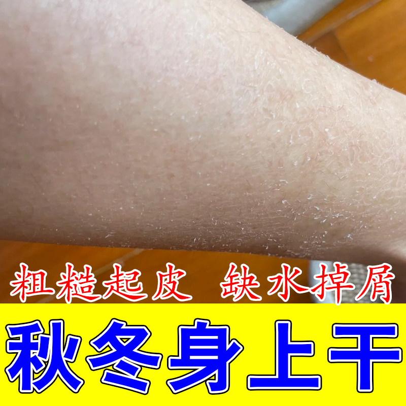 腿上粗糙干痒白屑全身干痒干燥起皮粗糙修护补水保湿皮肤甘油