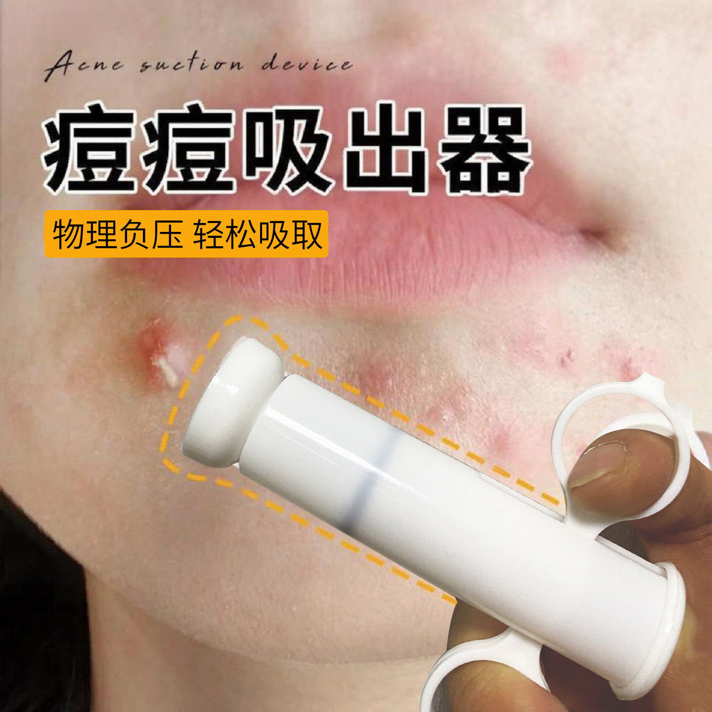 痘痘吸出器男女脸部面部毛囊暗疮专用粉刺毛孔手动美容清洁工具