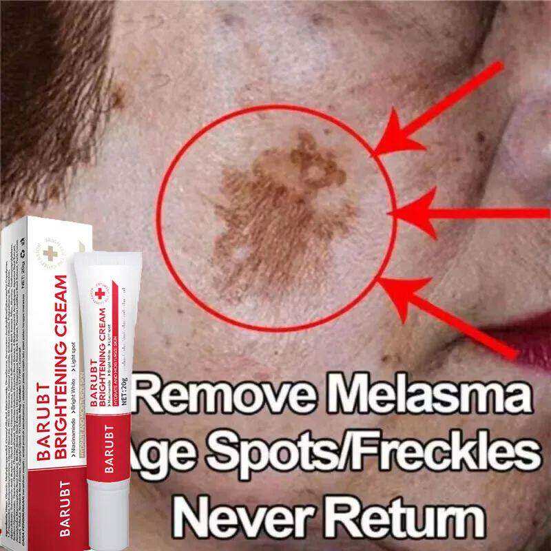 Powerful Spot-removing Whitening Cream Brighten Skin Fast El