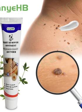 Warts Remover Ointment Wart Treatment Cream Skin Tag Remove
