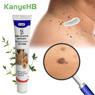 Warts Remover Ointment Wart Treatment Cream Skin Tag Remove