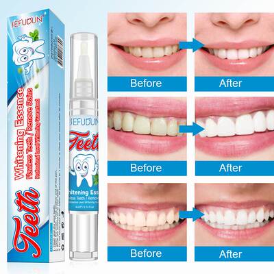 Teeth Whitening Pen Cleaning Serum牙笔除烟渍黄菌斑洁牙神器男