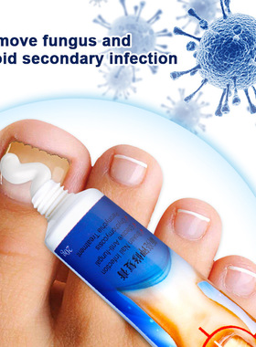 23g Nail Fungus Removal Cream Nail Care Ointment Anti-infect