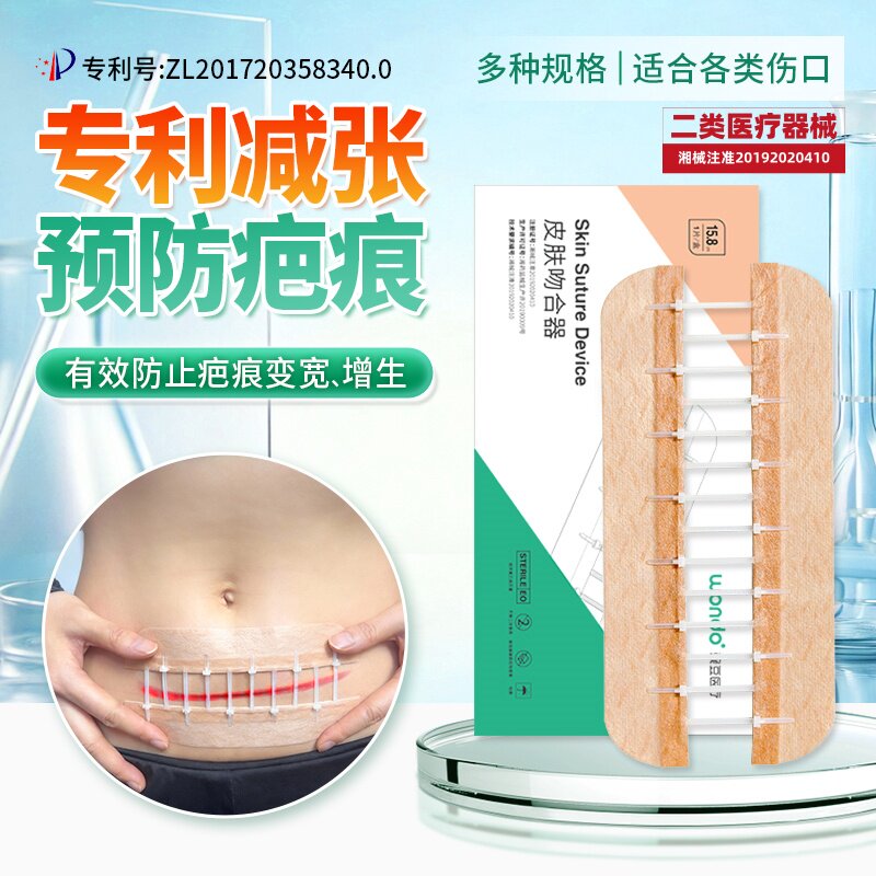 可回调医用减张器拉链式伤口愈合免缝剖腹产皮肤吻合器疤痕减张贴