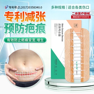 可回调医用减张器拉链式伤口愈合免缝剖腹产皮肤吻合器疤痕减张贴