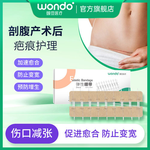 豌豆医疗医用减张器防止疤痕变宽