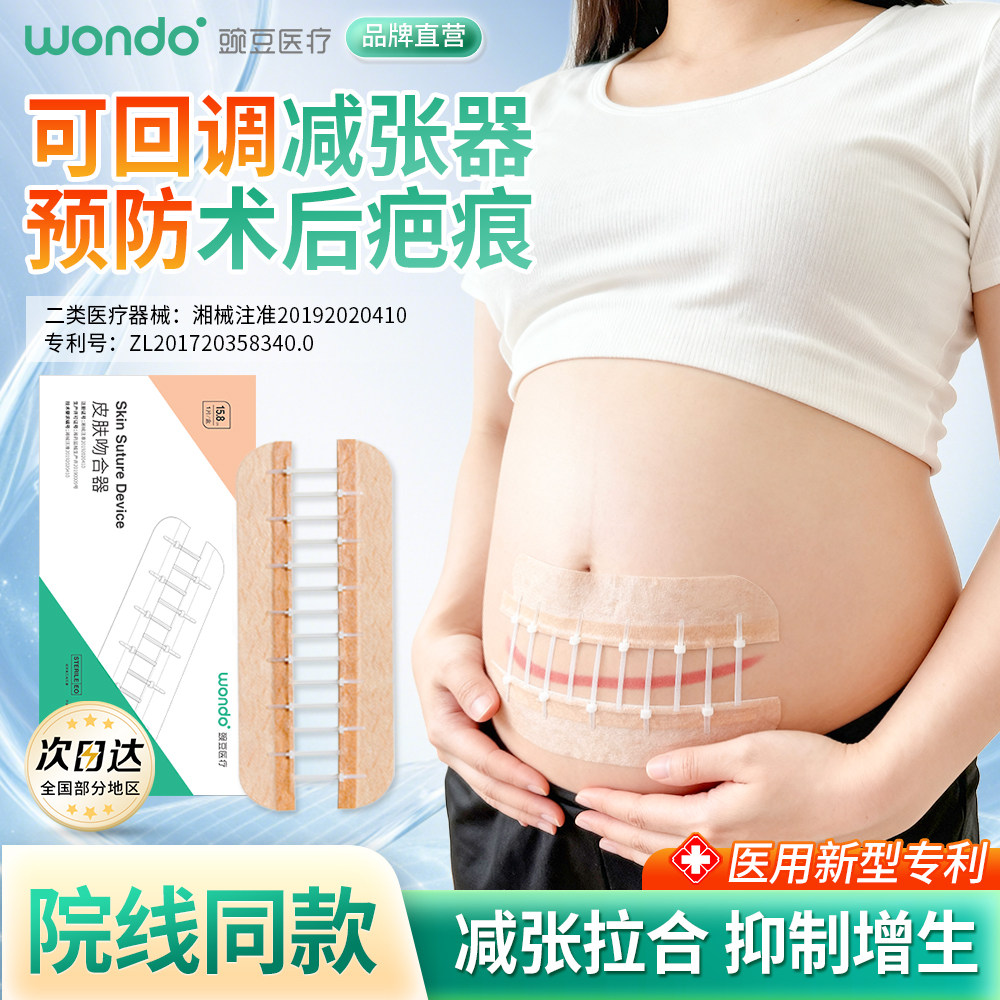豌豆医用减张器剖腹产疤痕祛痣伤口免缝合皮肤吻合器减张贴吻妥贴
