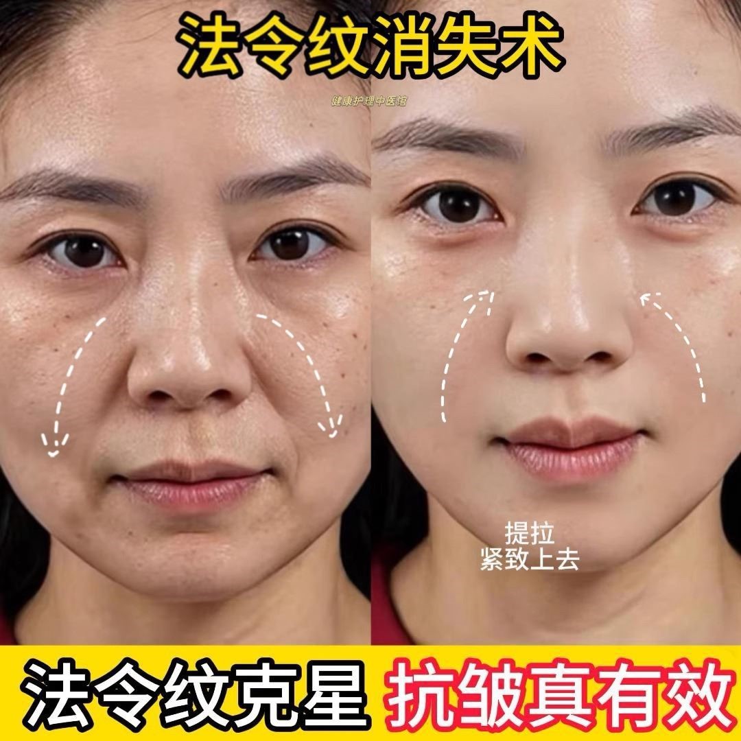 【屈臣氏爆卖】6D凝水微晶贴淡化法令纹嘴角纹提拉紧致非小工具