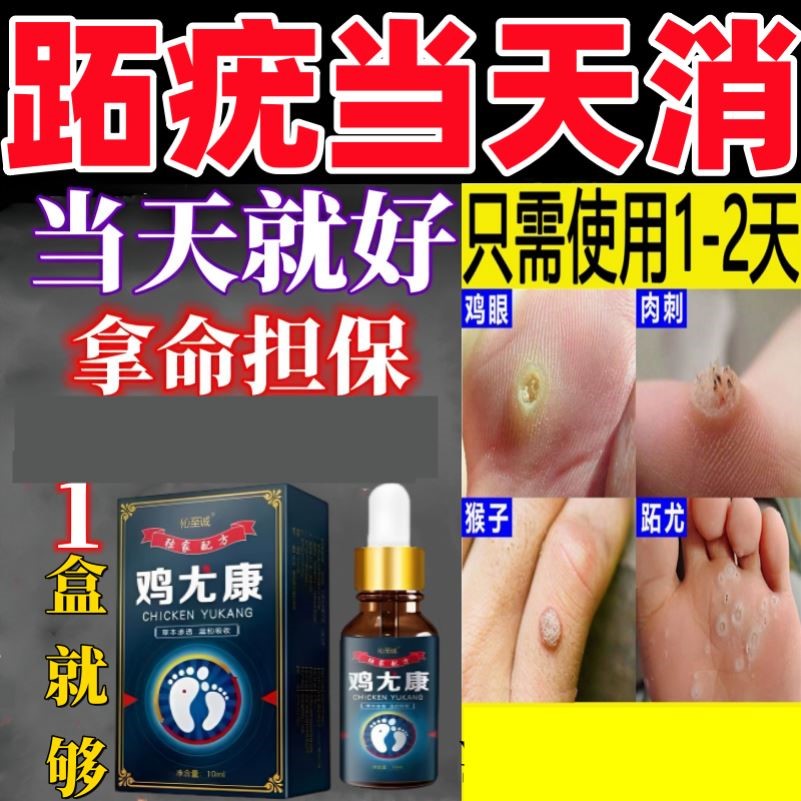 跖疣药膏根去专用手上足部脚底肉刺猴鸡眼药贴一次净去除神器药水