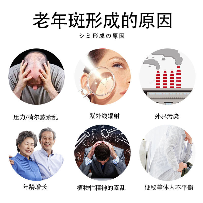 祛斑去斑专用药霜老年斑祛黄褐斑雀斑去除黑色素药水