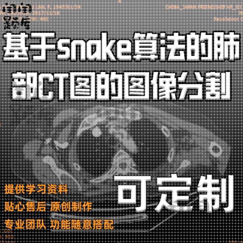 基于snake算法的肺部CT图的图像分割/数据分割技术