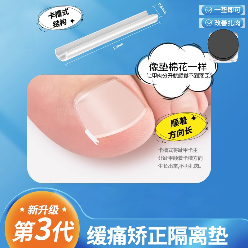 甲沟娇正神器炎脚指甲