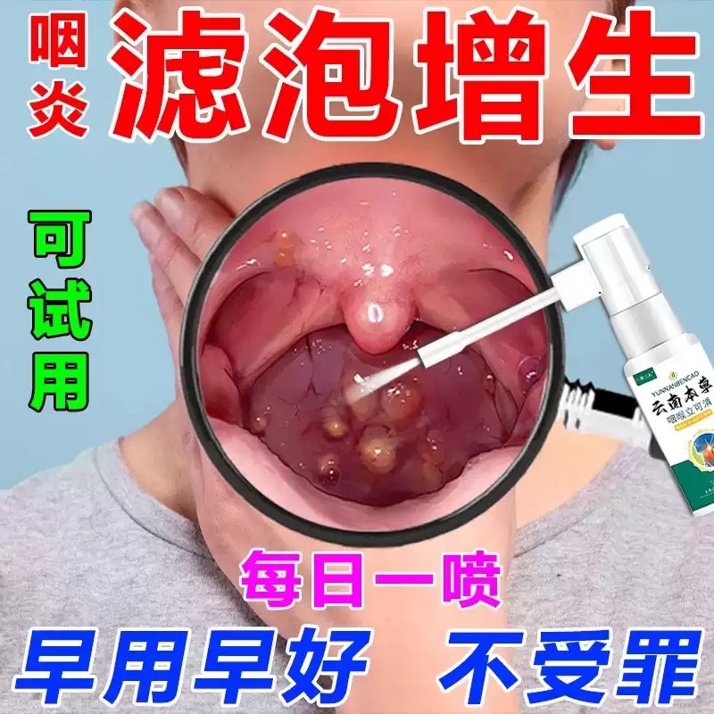 喉咙滤泡增生咽喉焱淋巴滤泡