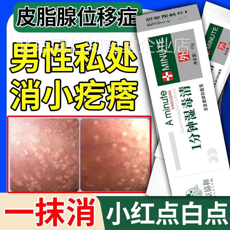 增皮脂腺异位症阴茎阴囊包皮皮脂腺异位生殖器生毛囊炎小疙瘩丘疹