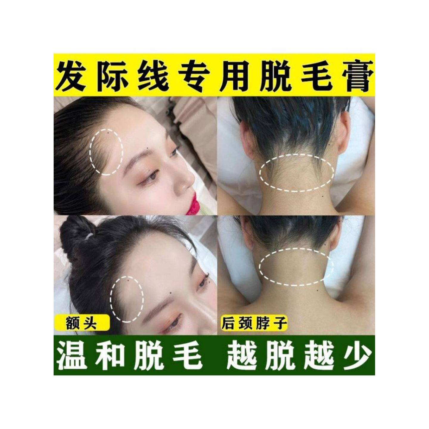 南京同仁堂爱肤宜脱毛膏私处温和男女不永久全身去腋下腿毛腋毛