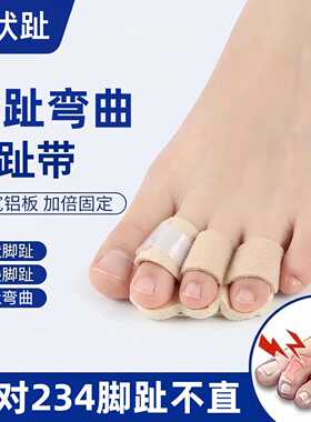 脚趾弯曲分趾带锤状趾伸直铝条