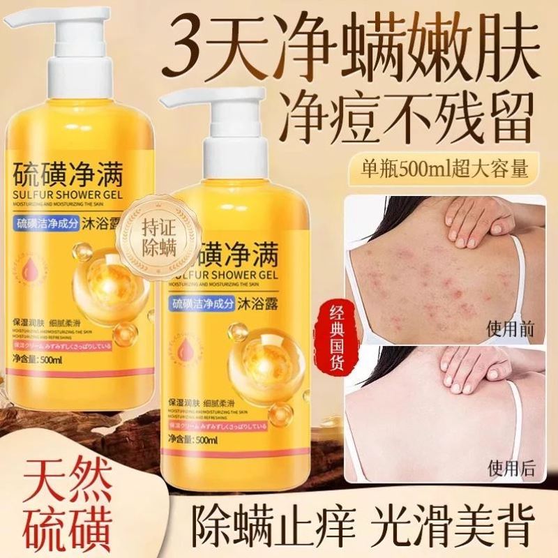 硫磺除螨沐浴露皮肤瘙痒后背祛痘女男士成人正品官方品牌持久留香