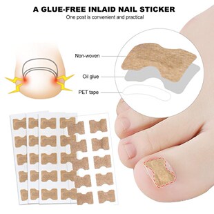 Ingrown Toenail Sticker Nail-Corrector Foot-Care Glue