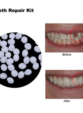 Gap Denture Adhesive Tooth-Repair-Kit Solid-Glue Dental-Rest