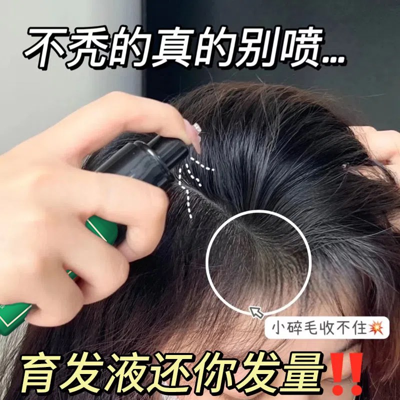 增发救星|防脱发育o发液精华洗发水生发增发密发液中药生长喷雾
