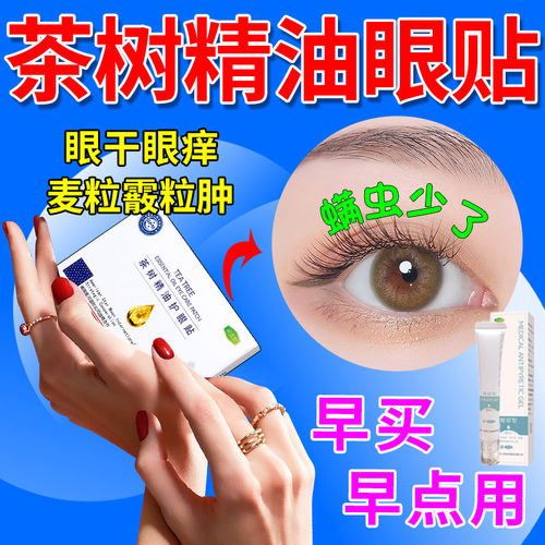 茶树精油除螨眼贴眼痒眼睑清洁