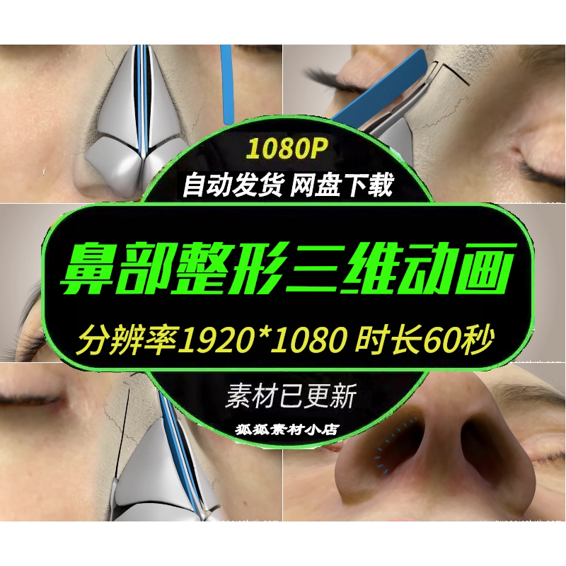 鼻部整形三维详解科普动画素材