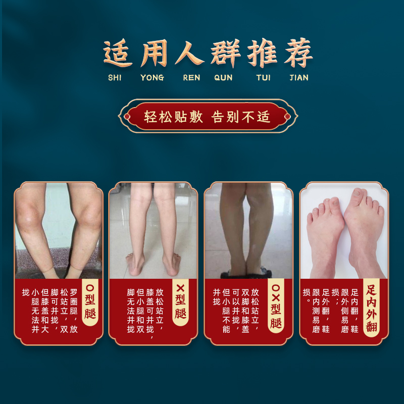 当晚就直o型腿矫正神器男女通用O型腿X型腿罗圈腿矫正专用贴