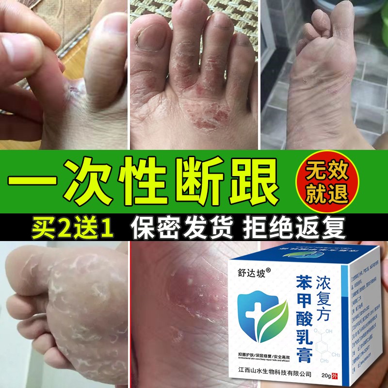 浓复方苯甲酸软膏丶效果保证