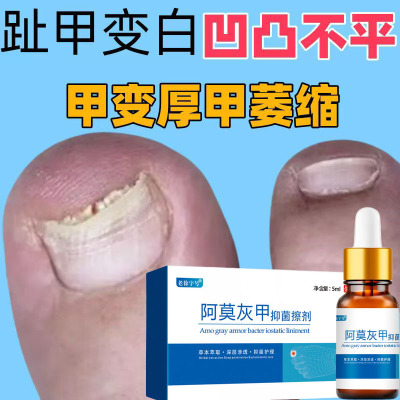 灰指甲药抑菌专用液无痛去除增厚脱甲膏软甲灰甲净冰醋酸外用正品