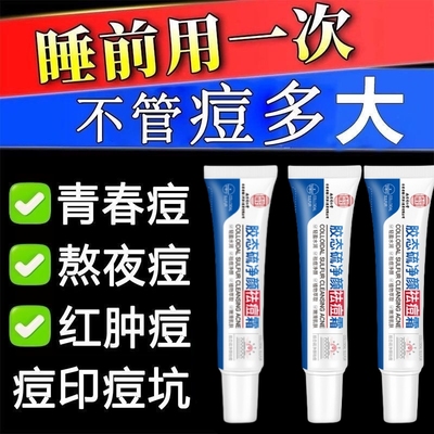 痘痘修复消炎痘印去除胸口后背青春痘粉刺闭口治玫瑰痤疮祛痘药膏