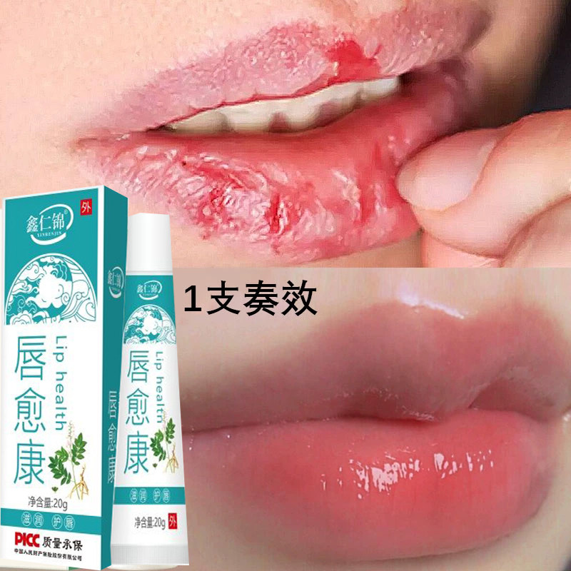 改善唇周黑嘴角暗沉儿童成人通用