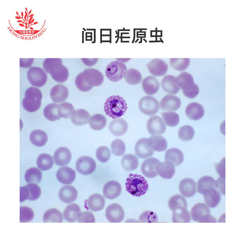 速发间日疟原虫装片涂片高校教学玻片医学科研寄生虫类显微镜观察