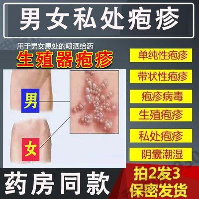 带状疱疹后遗症神经痛外用私处带状康蛇盘疮蛇胆疮蛇缠腰疱疹病毒