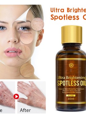 Ultra Brightening Spotless Oil Dark Spots Remove Ance Burn S