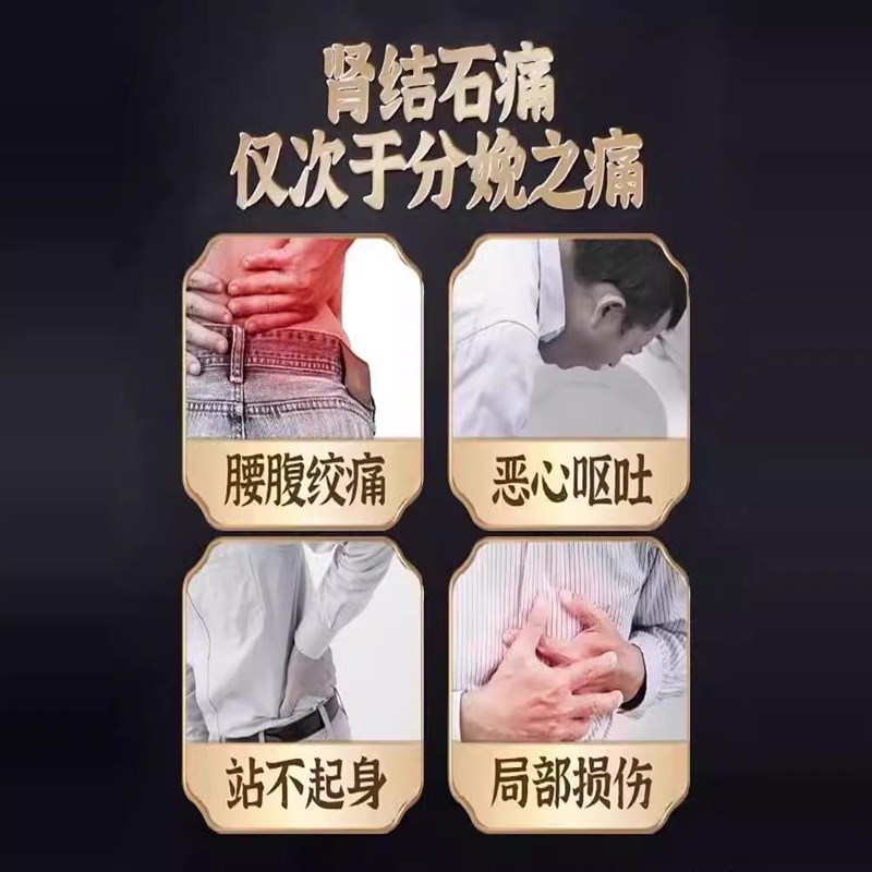 胆肾囊结石溶石化石排石专用的药治疗鸡J内金碎石丸尿特效去输尿