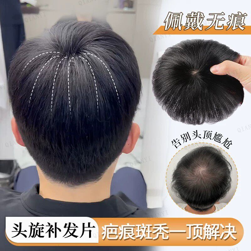 小面积头旋假发补发片