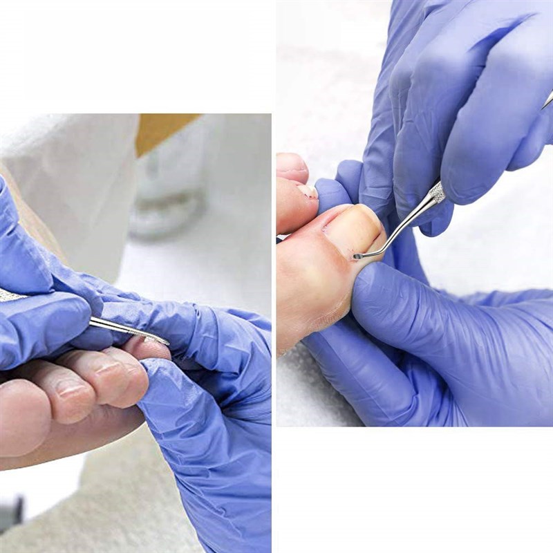 Stainless Steel Nail Clipper Toenail File Cleaner for Ingrow